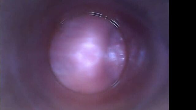 Camera inside (18+)