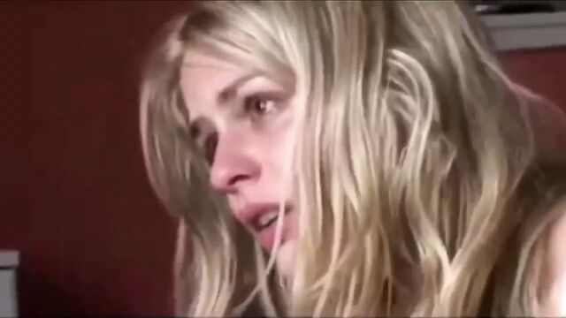 Facial anal pain