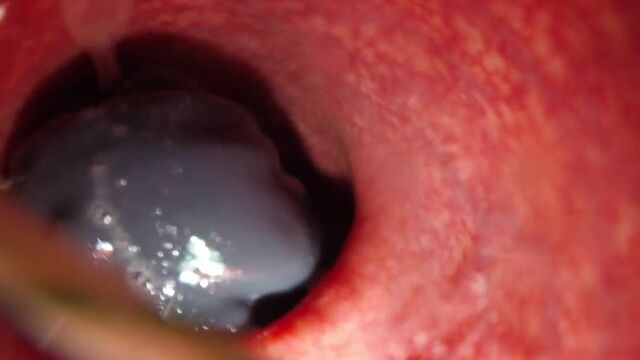 CAMERA INSIDE THE VAGINA AND ASS Porn, sex.anal, incest, cunnilingus, fucking, cumming, fucking, hidden camera